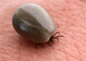 Garrapata cobra vida de un niño de 7 años