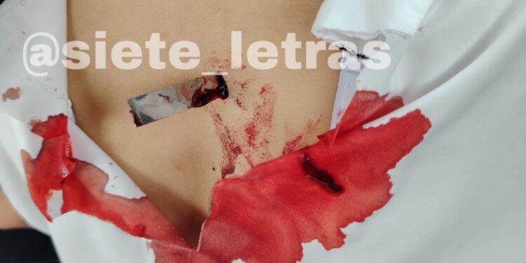 Filtran video de indigente que apuñaló a joven